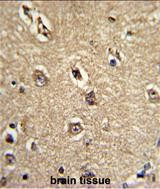 Beclin 1 Antibody in Immunohistochemistry (Paraffin) (IHC (P))