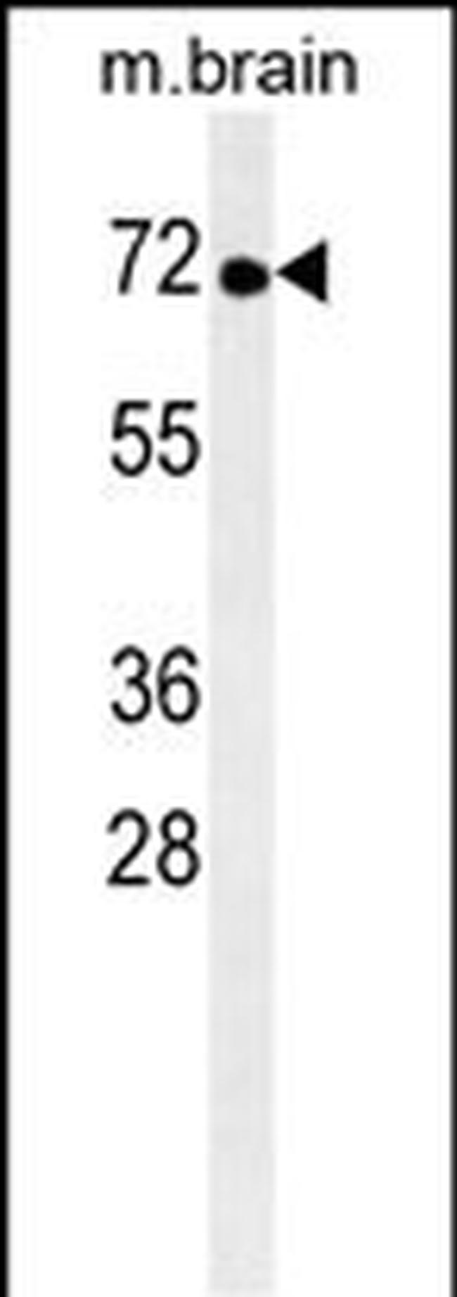 TNK1 Antibody in Western Blot (WB)