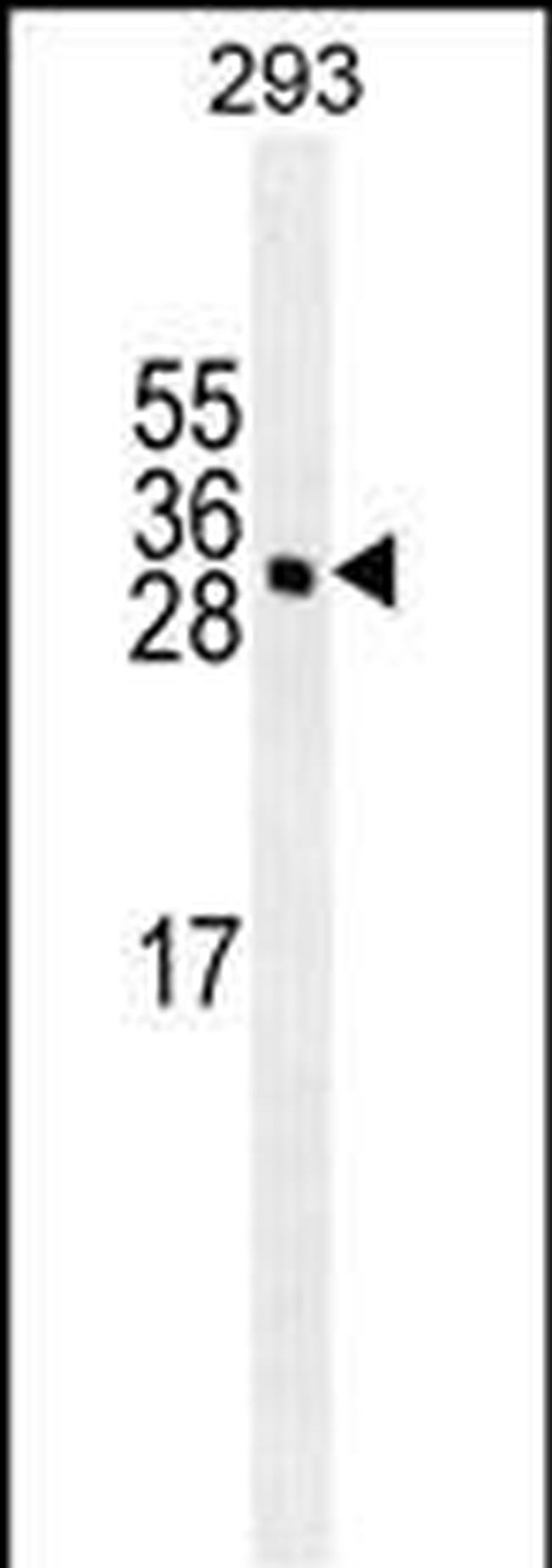 GAS41 Antibody in Western Blot (WB)