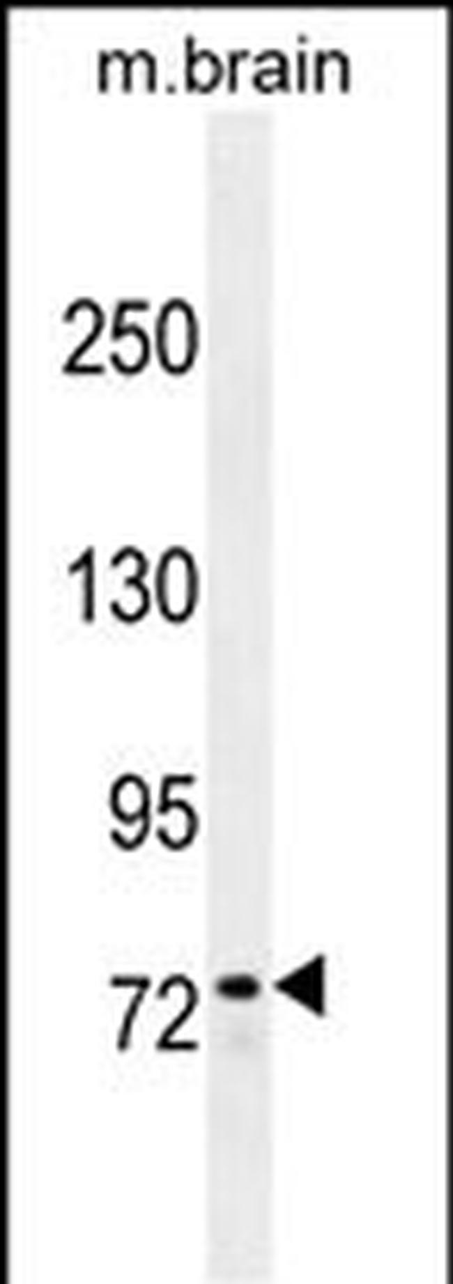 ZFP37 Antibody in Western Blot (WB)
