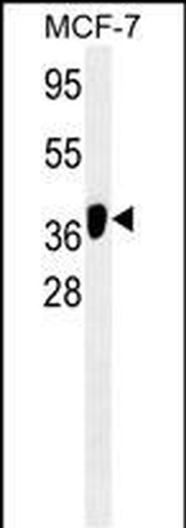 ATG4B Antibody in Western Blot (WB)