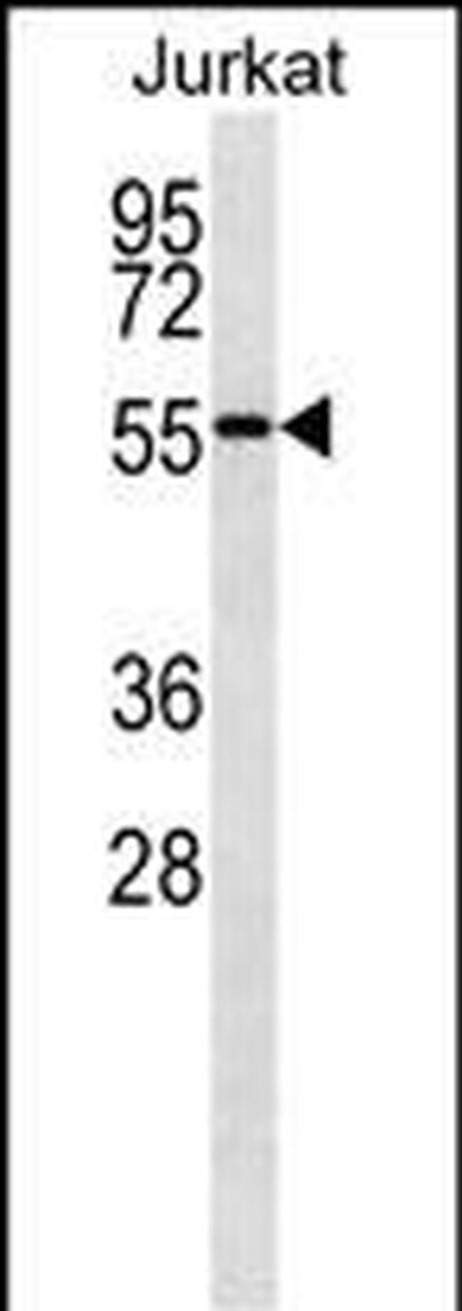 NUP50 Antibody in Western Blot (WB)