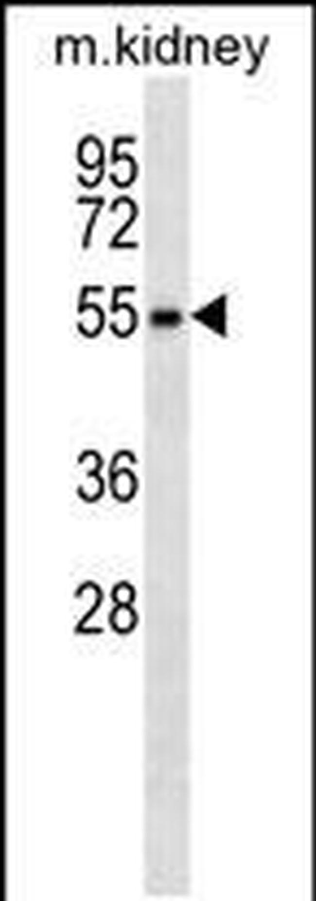 RPS6KL1 Antibody in Western Blot (WB)
