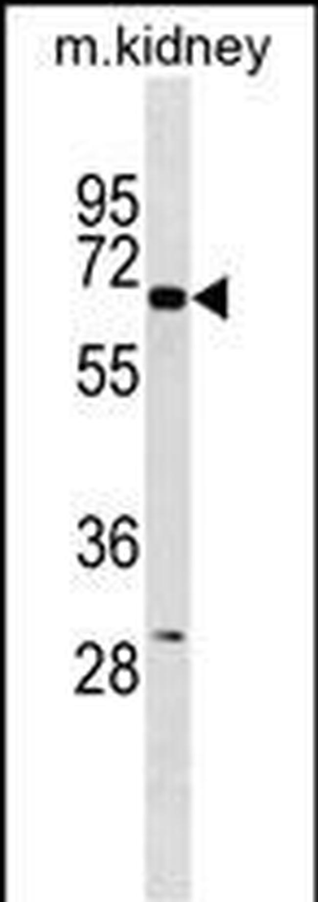 Kir3.1 (KCNJ3) Antibody in Western Blot (WB)