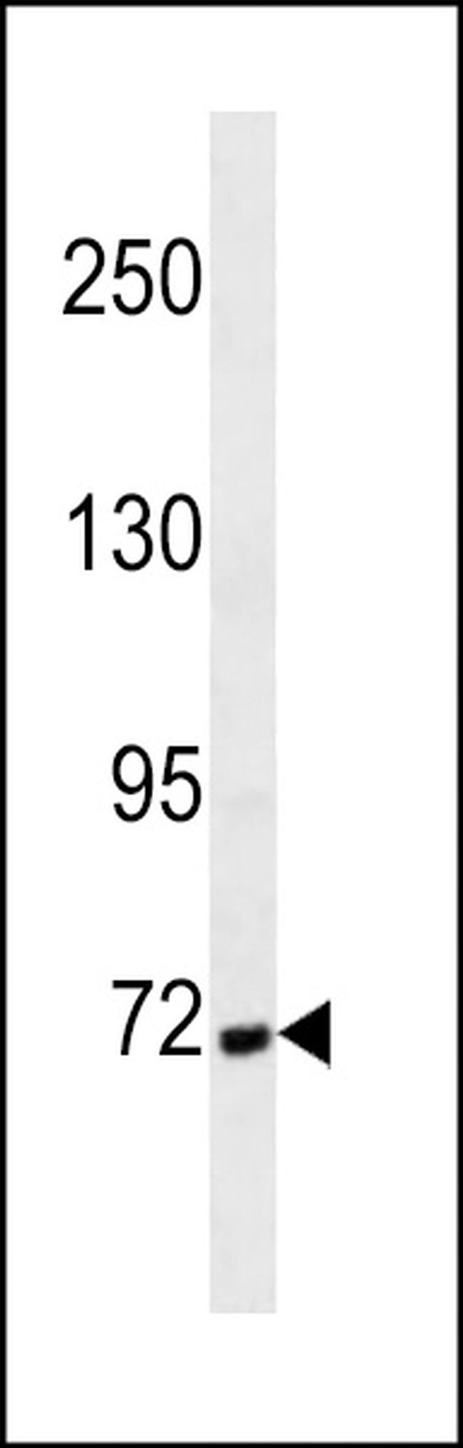 Cortactin Antibody in Western Blot (WB)