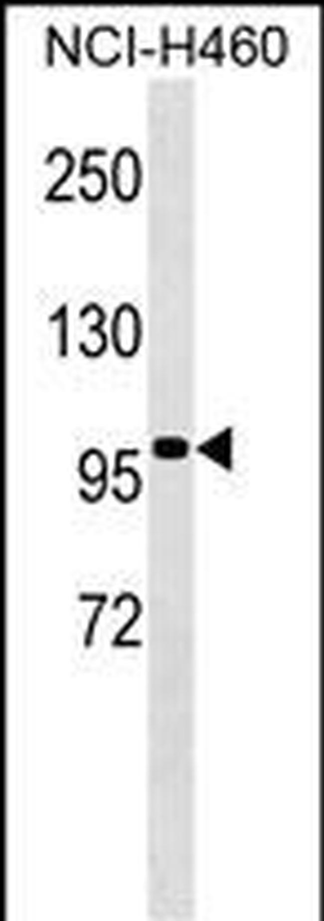 TLE4 Antibody in Western Blot (WB)
