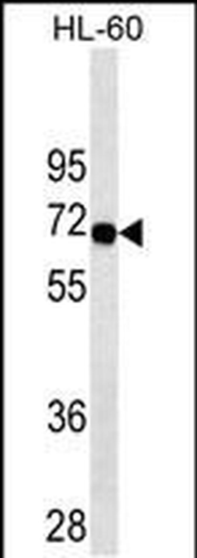 SWAP70 Antibody in Western Blot (WB)