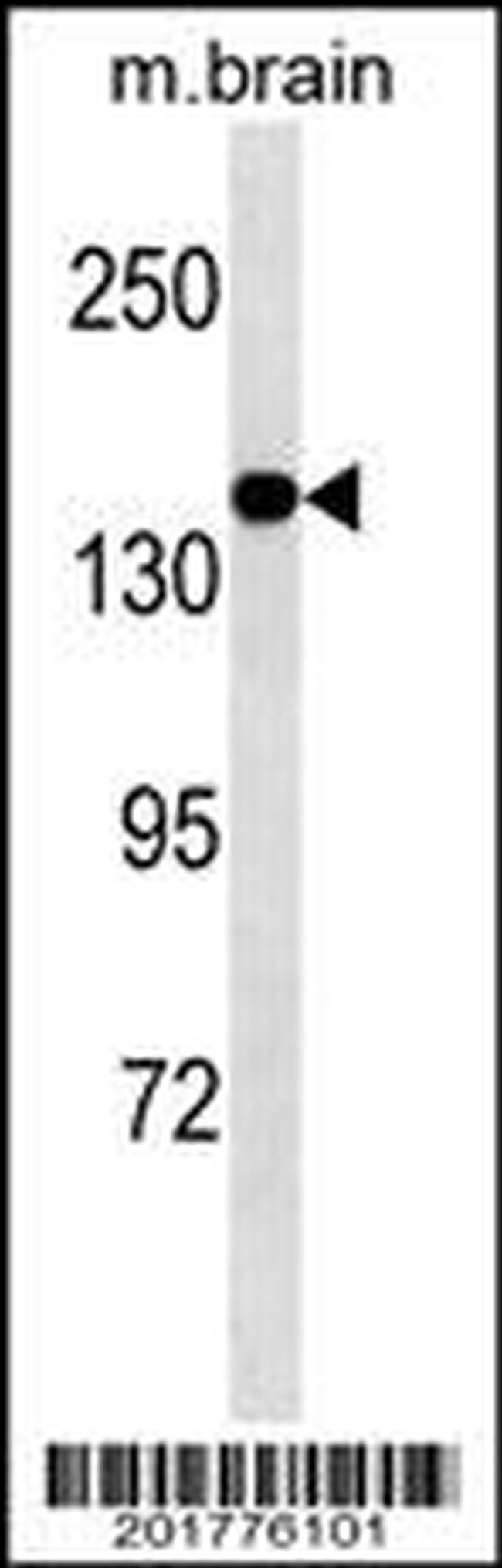 MED14 Antibody in Western Blot (WB)