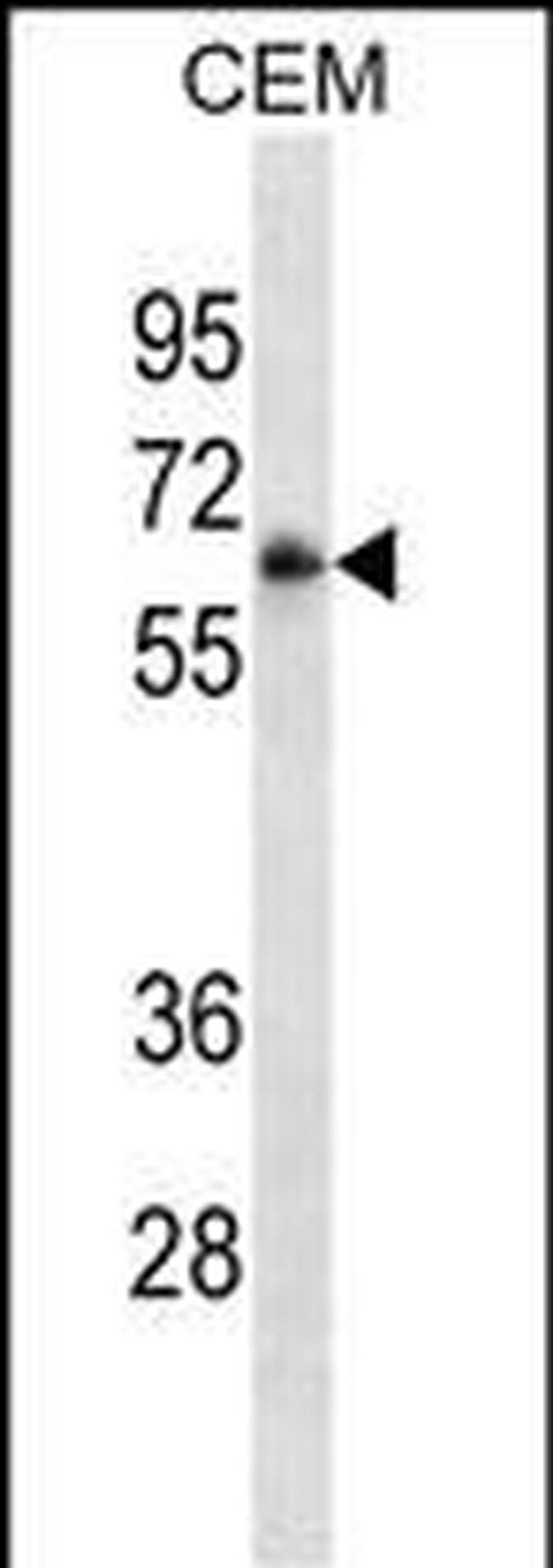 CD16 Antibody in Western Blot (WB)