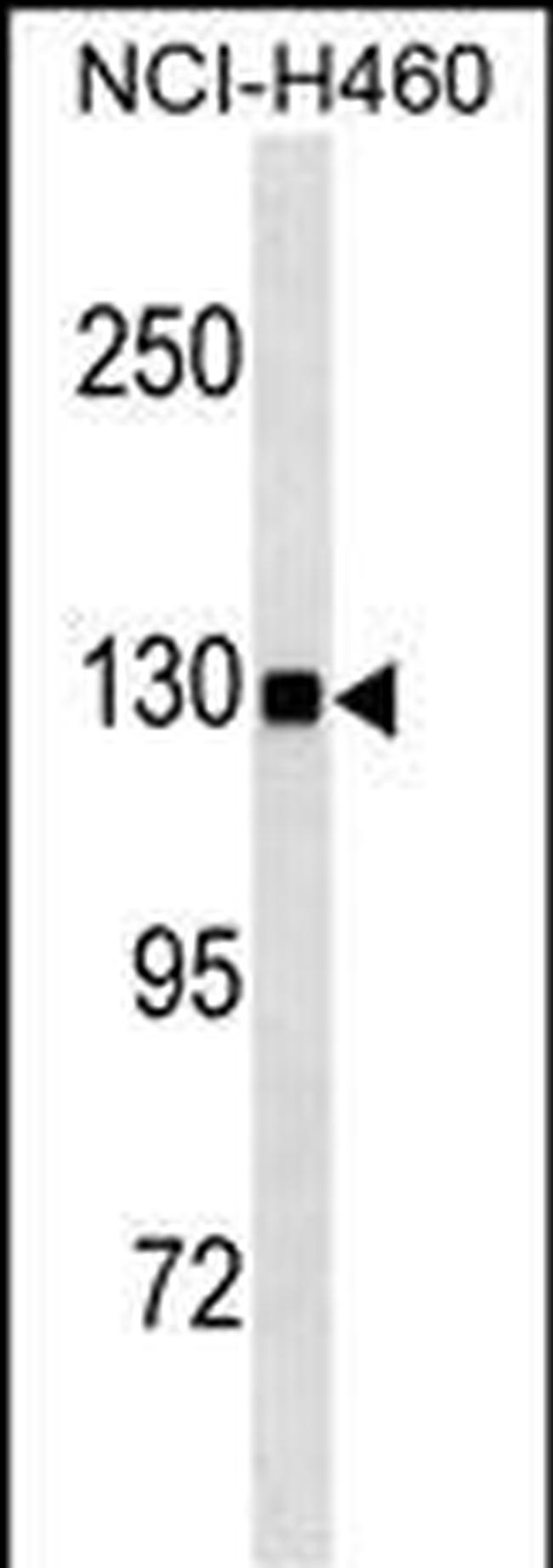 USP8 Antibody in Western Blot (WB)