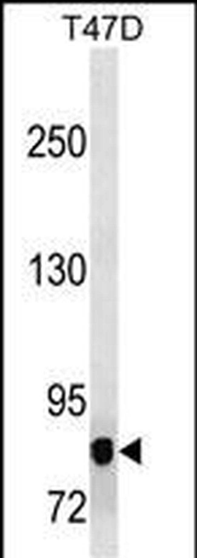 ZPK Antibody in Western Blot (WB)
