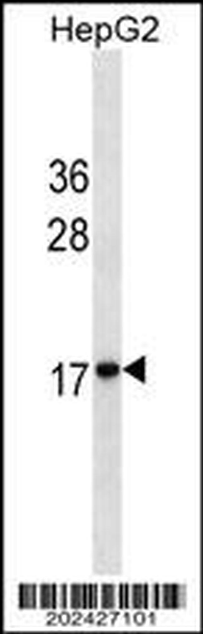 HMGA2 Antibody in Western Blot (WB)