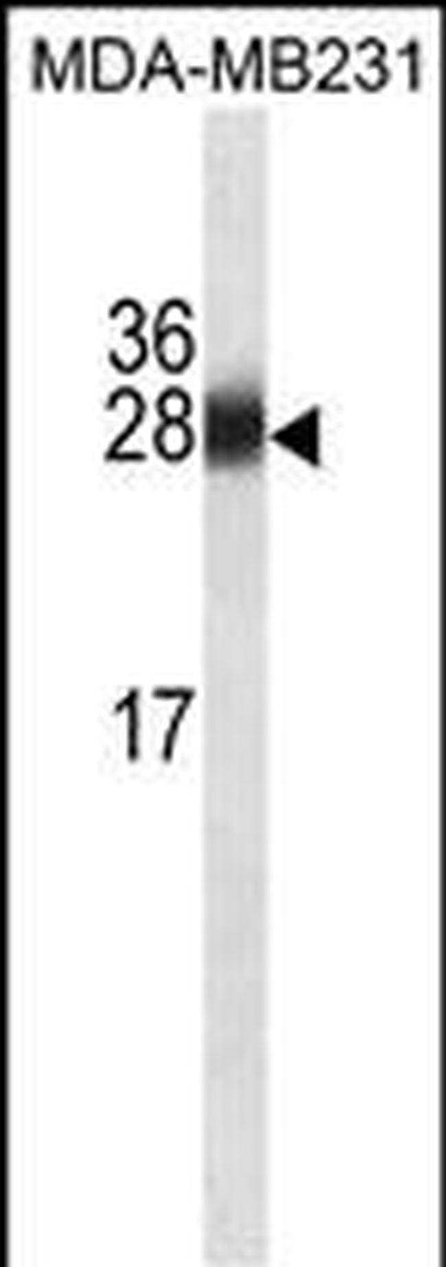 GSTM1 Antibody in Western Blot (WB)