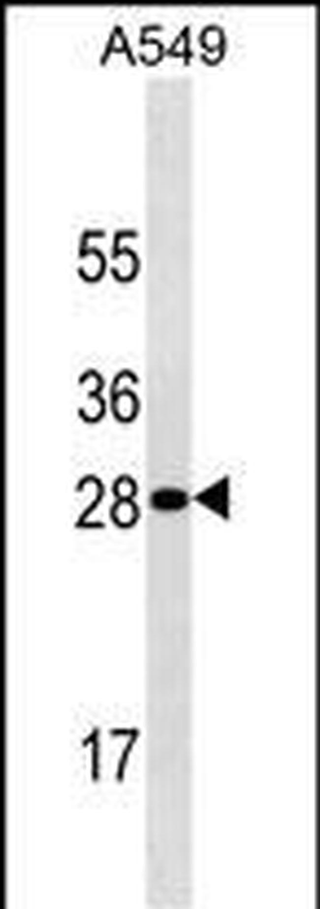 HPRT1 Antibody in Western Blot (WB)