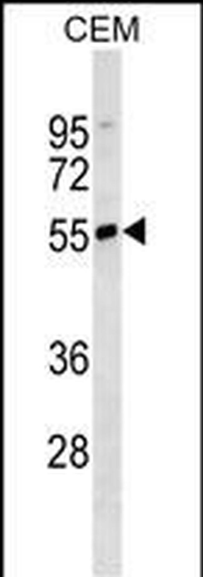 Human IgD Antibody in Western Blot (WB)