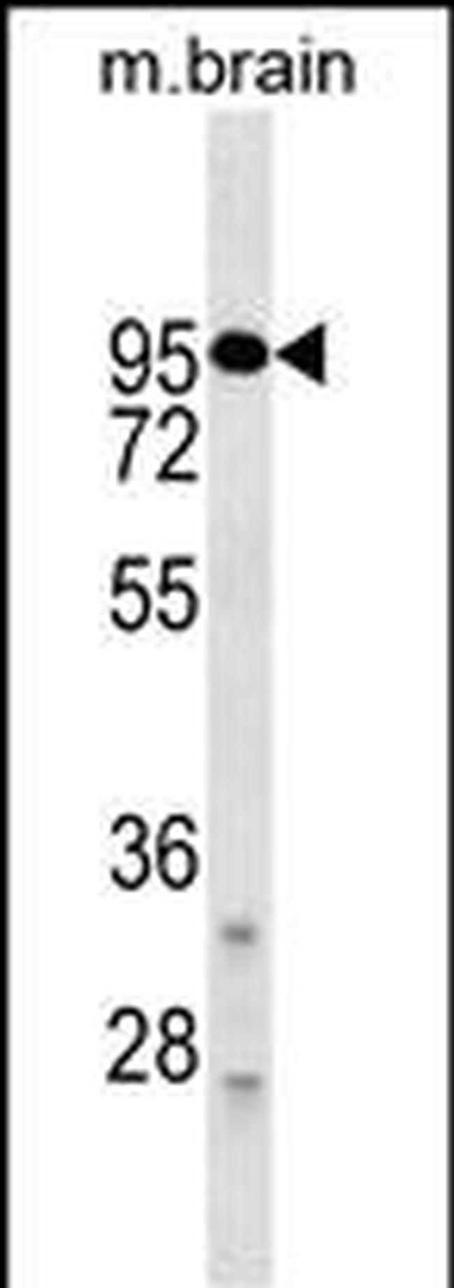 DRD2 Antibody in Western Blot (WB)
