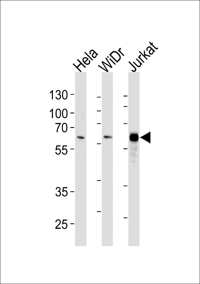 HDAC1 Antibody in Western Blot (WB)