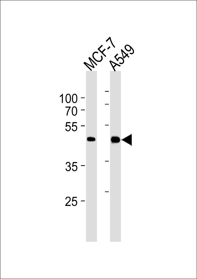 CDK20 Antibody in Western Blot (WB)