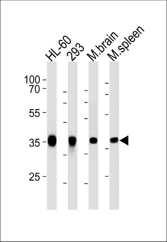 Aldolase C Antibody in Western Blot (WB)