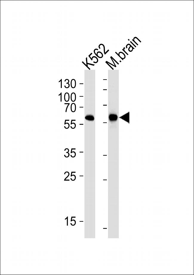 BAIAP2 Antibody in Western Blot (WB)