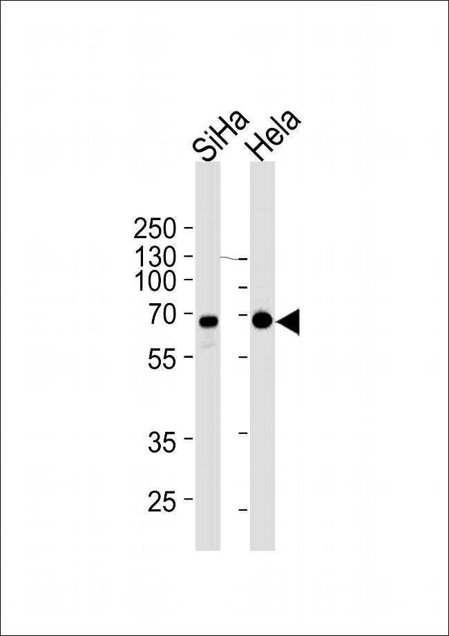 NLK Antibody in Western Blot (WB)