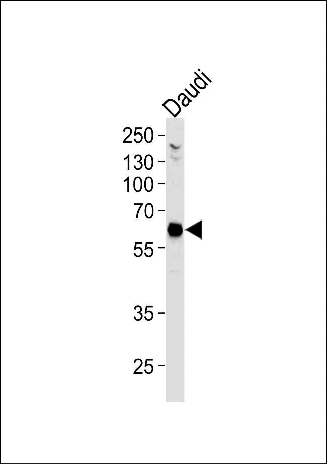 USP22 Antibody in Western Blot (WB)