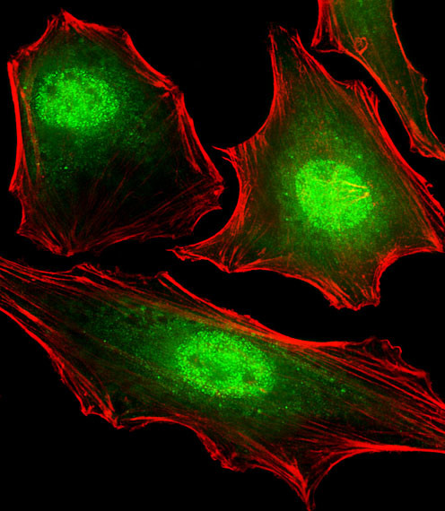 FUBP3 Antibody in Immunocytochemistry (ICC/IF)