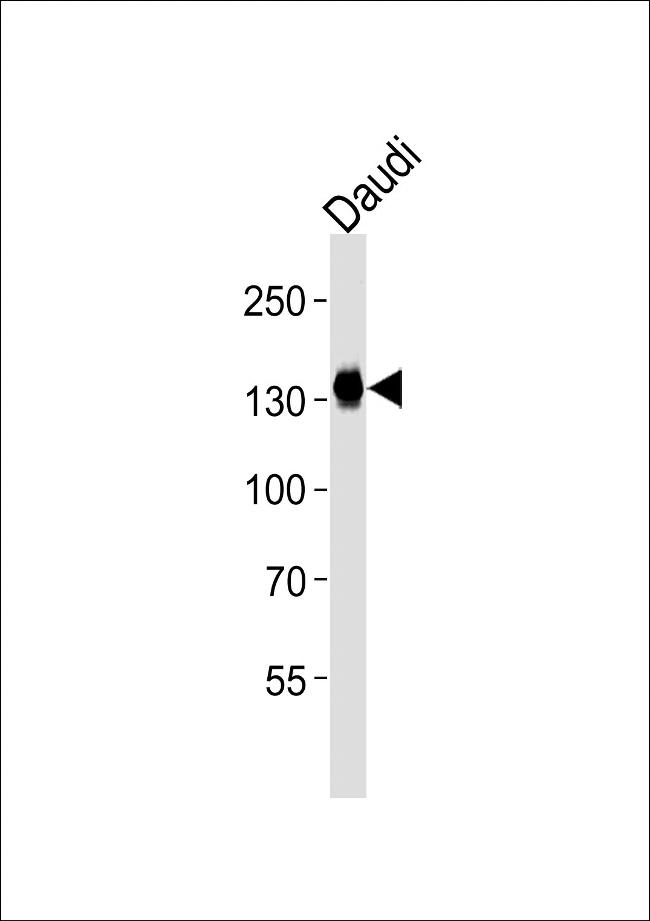 USP25 Antibody in Western Blot (WB)