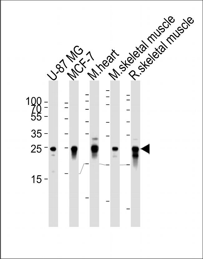 CRYAB Antibody in Western Blot (WB)