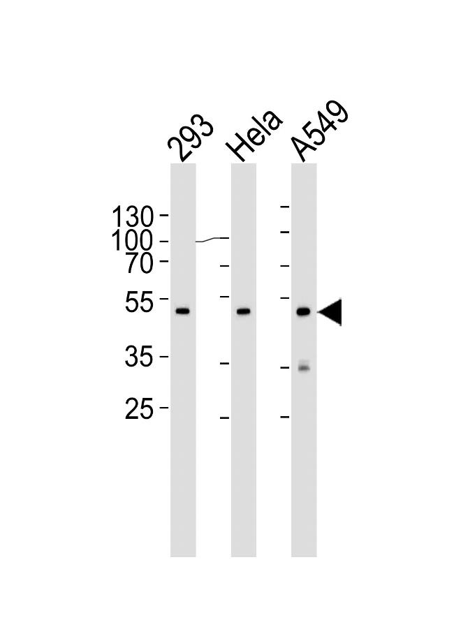 CBX8 Antibody in Western Blot (WB)