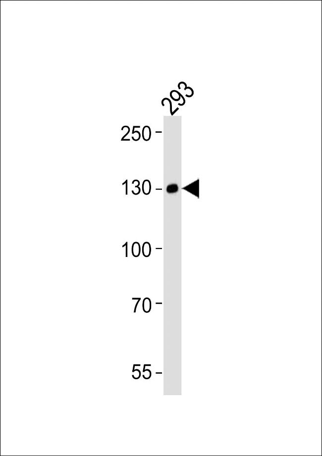 EphA6 Antibody in Western Blot (WB)