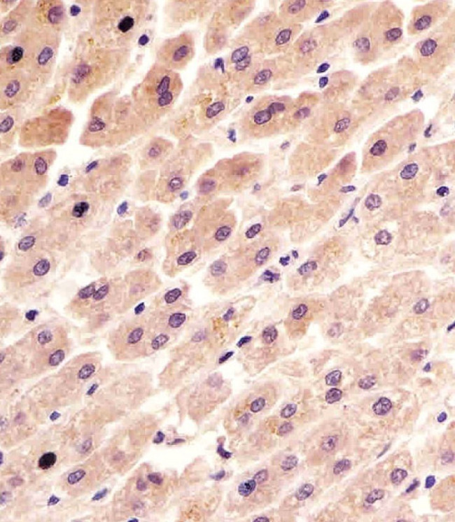 FER Antibody in Immunohistochemistry (Paraffin) (IHC (P))