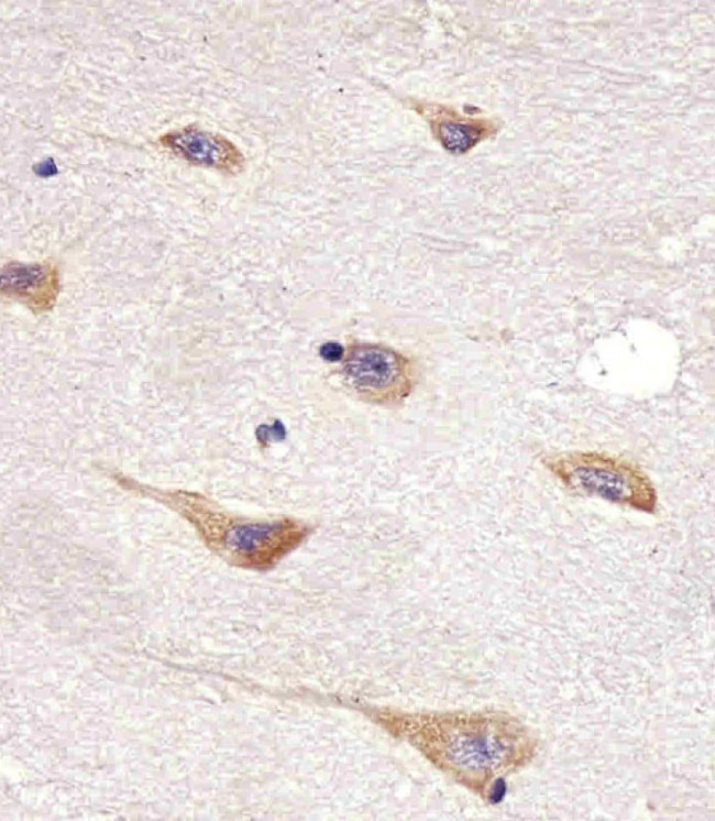 AATK Antibody in Immunohistochemistry (Paraffin) (IHC (P))