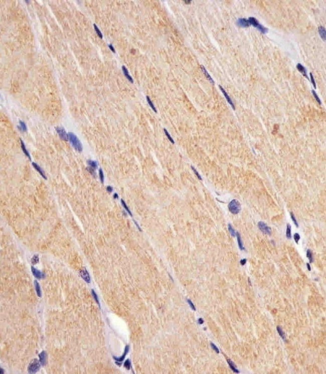 FES Antibody in Immunohistochemistry (Paraffin) (IHC (P))