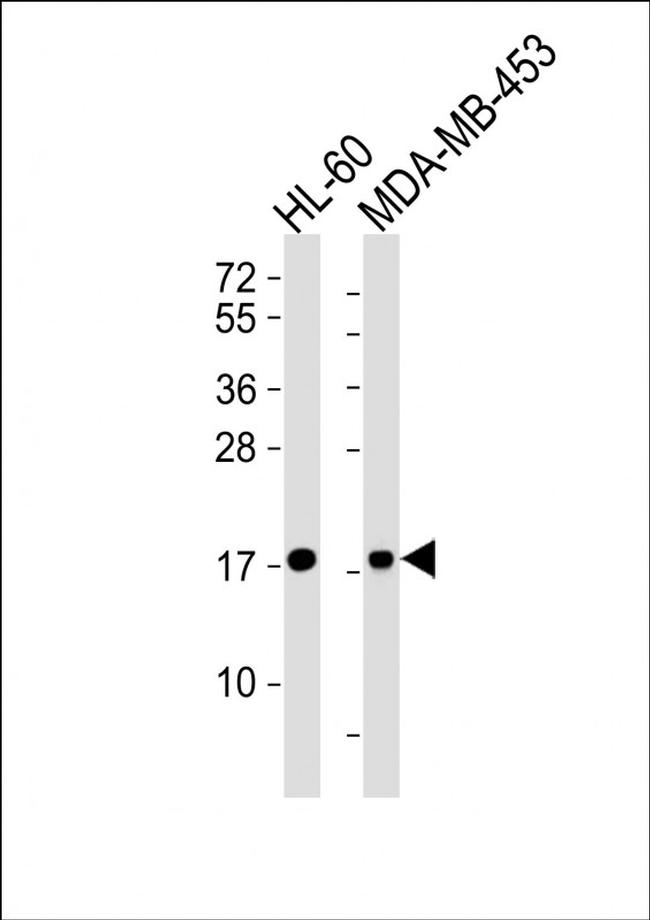 FHIT Antibody in Western Blot (WB)