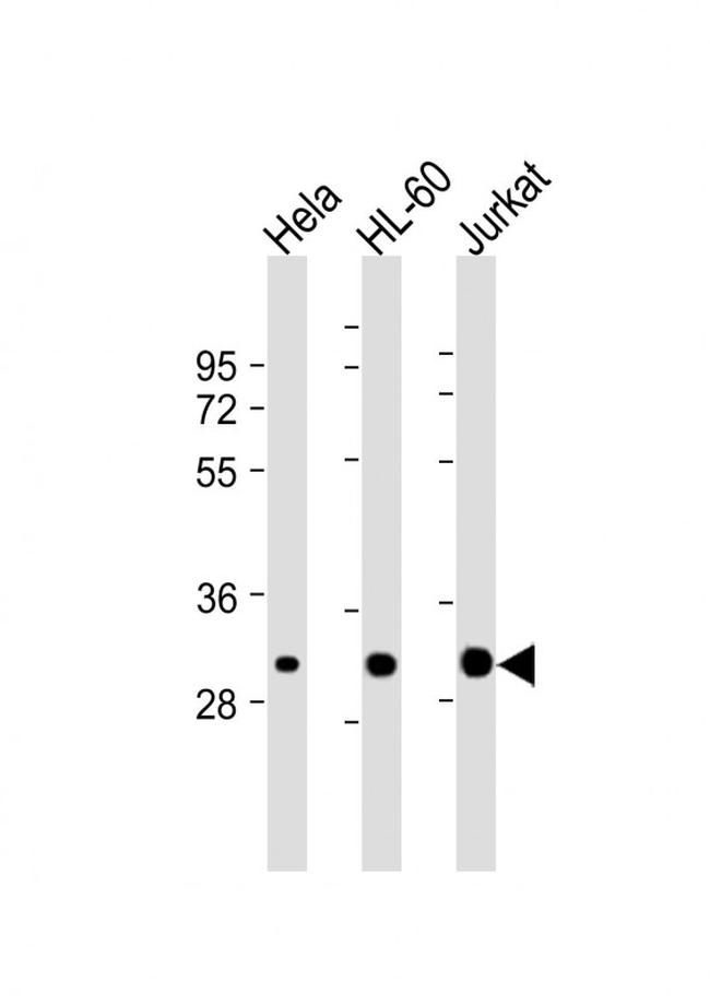 CDK2 Antibody in Western Blot (WB)