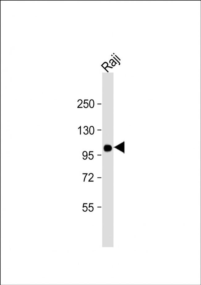 VAV1 Antibody in Western Blot (WB)
