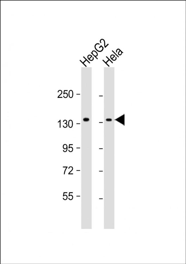 RBM6 Antibody in Western Blot (WB)