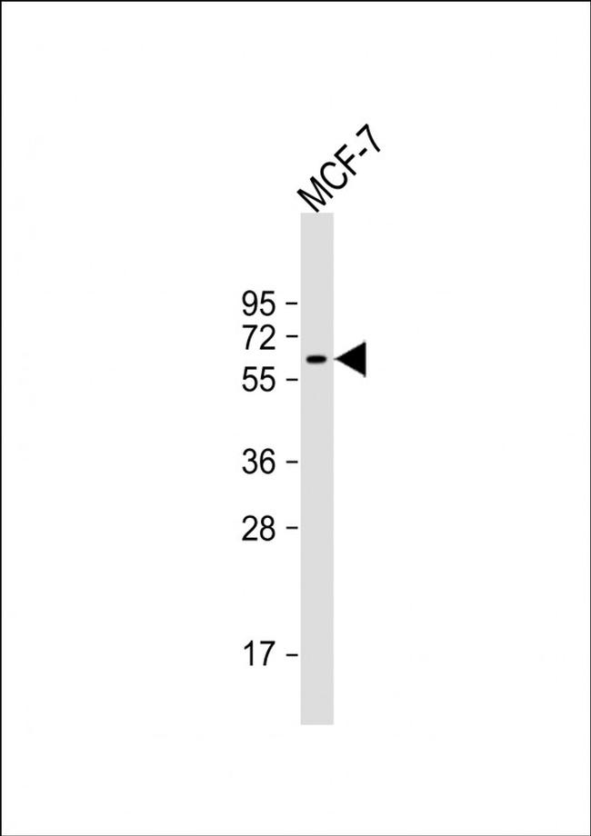 YES1 Antibody in Western Blot (WB)