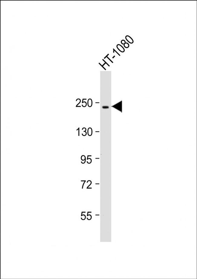 PBRM1 Antibody in Western Blot (WB)