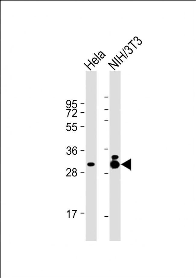 TPM3 Antibody in Western Blot (WB)