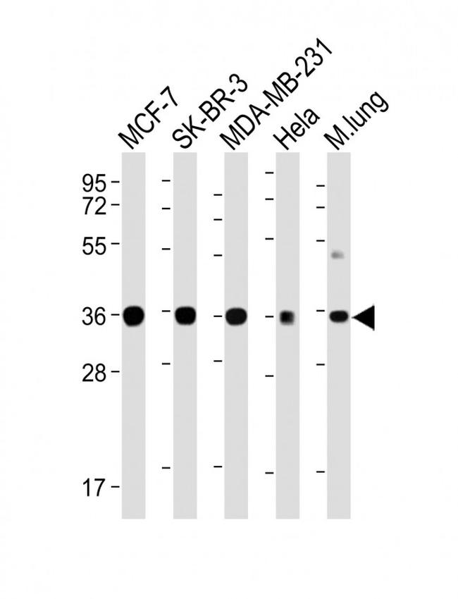 WNT4 Antibody in Western Blot (WB)