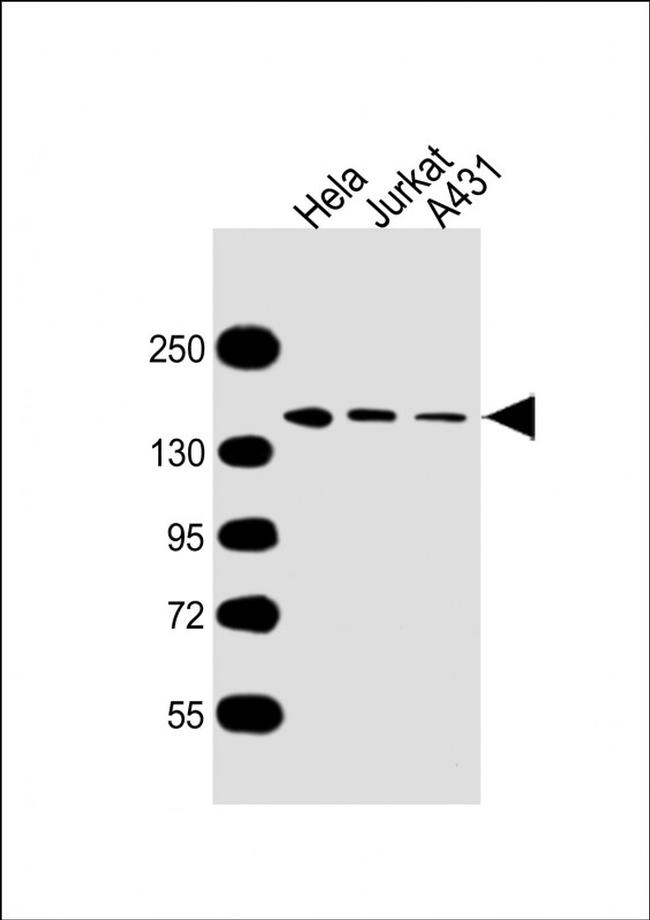MYBBP1A Antibody in Western Blot (WB)