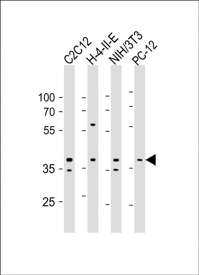 AMPK beta-1 Antibody in Western Blot (WB)