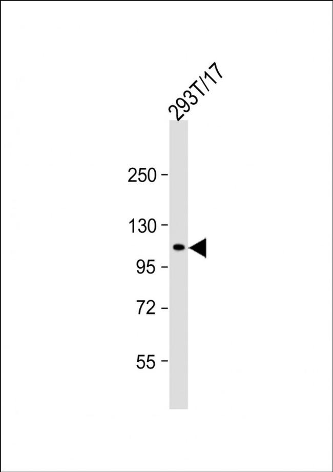 ECT2 Antibody in Western Blot (WB)