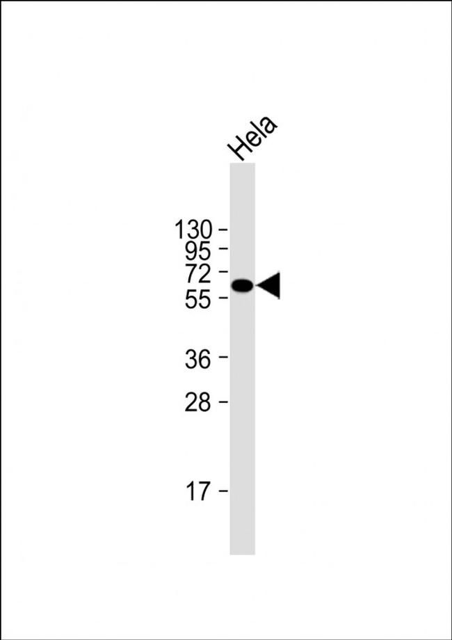 NPR3 Antibody in Western Blot (WB)
