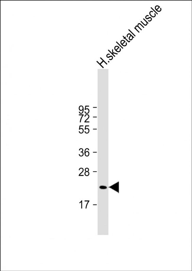 FNDC5 Antibody in Western Blot (WB)