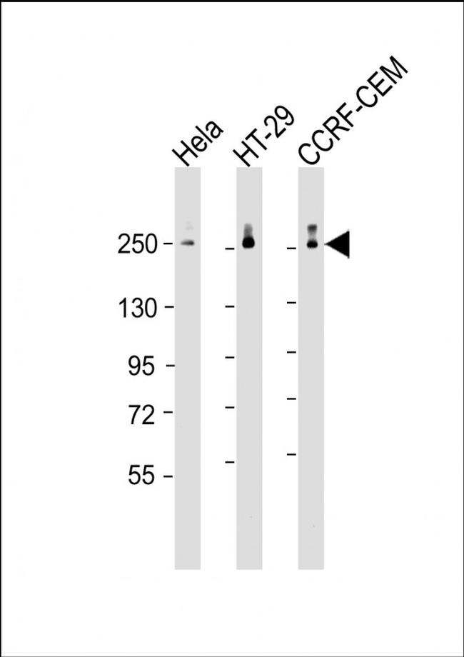 POLR2A Antibody in Western Blot (WB)