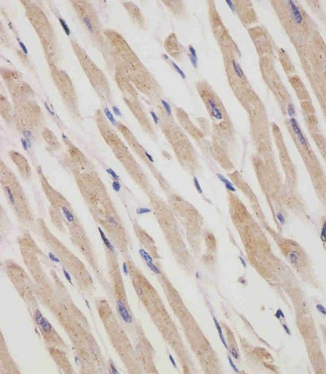 RANBP9 Antibody in Immunohistochemistry (Paraffin) (IHC (P))