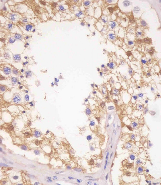 PDXK Antibody in Immunohistochemistry (Paraffin) (IHC (P))